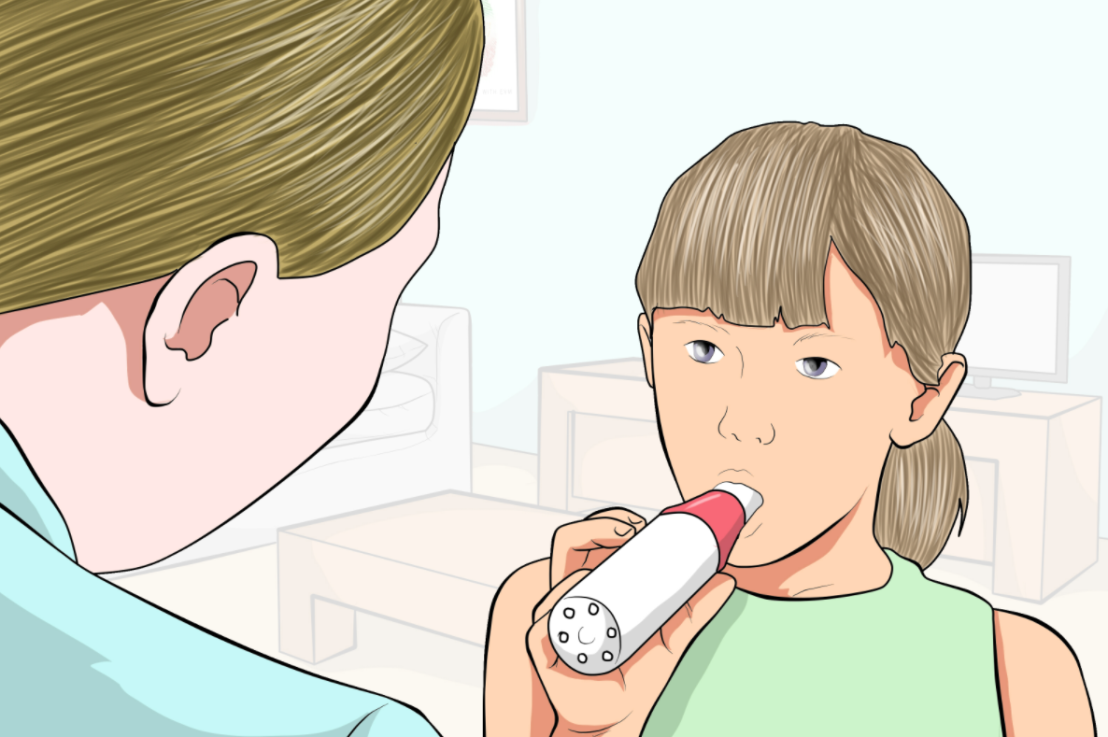Controlling Childhood Asthma with Seven Steps